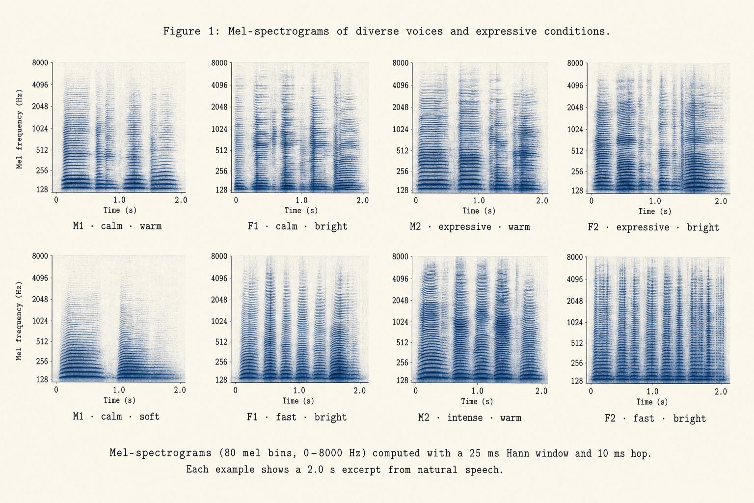 A grid of mel-spectrograms for different voices and emotions